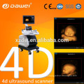 echo color doppler 4D function & vascular pregnancy ultrasound scanner & ultrasound scanner latest version USG with CE ISO